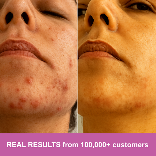 Reindeer Organ Superfood