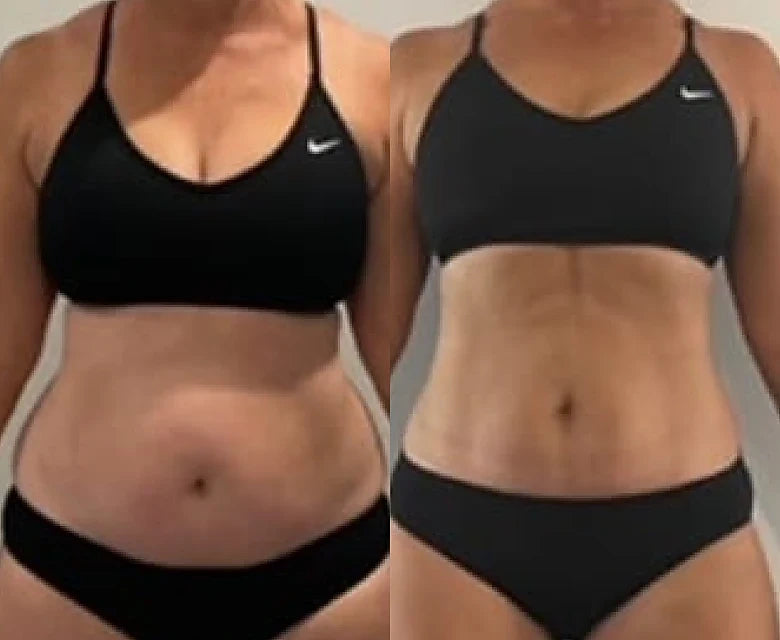 Before and after